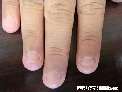 剪指甲、挖耳屎，这些日常小动作竟隐藏大危害！ - 梅州生活资讯 - 梅州28生活网 mz.28life.net